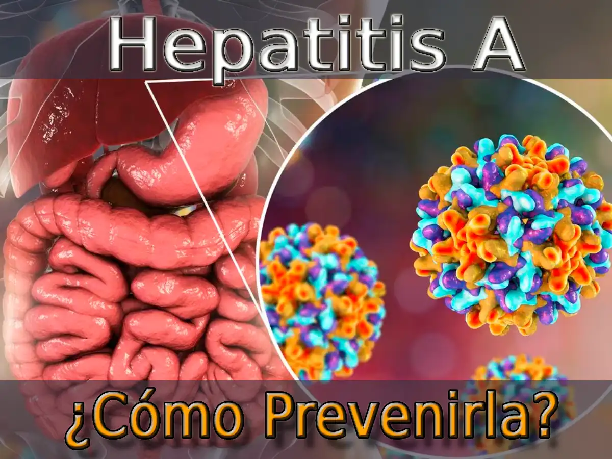 Hepatitis A: ¿Cómo Prevenirla?