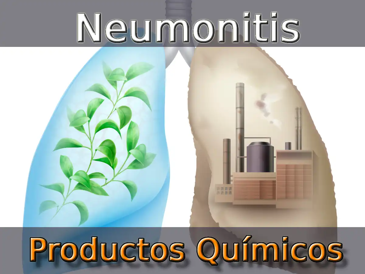 Neumonitis Por Productos Químicos