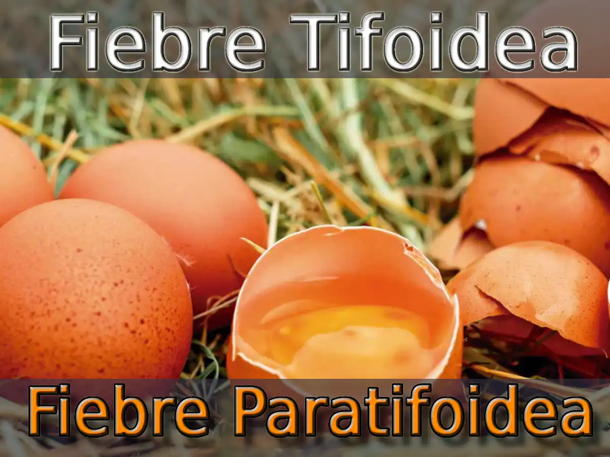 Fiebre Tifoidea Y Fiebre Paratifoidea