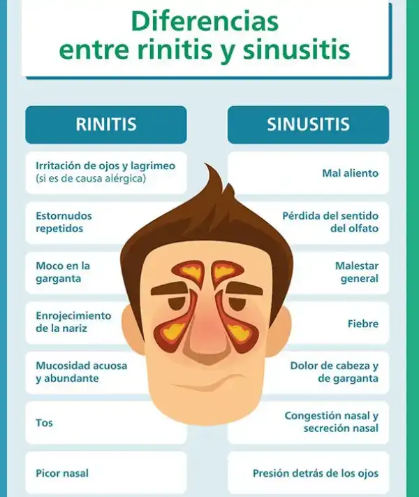 Diferencia-Rinitis-Sinusitis