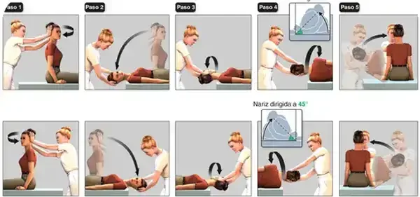 Fisioterapia-Vértigo