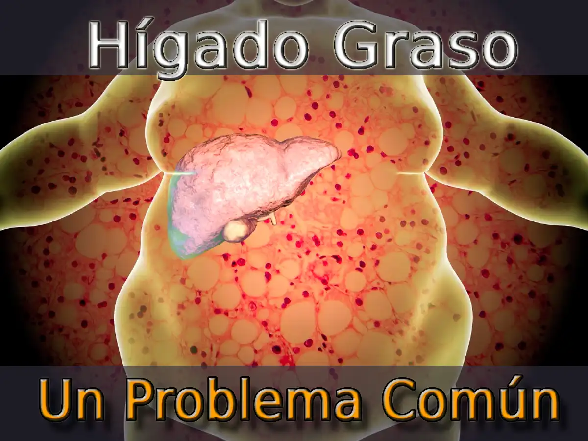 Hígado Graso: Un Problema Cada Vez Más Común