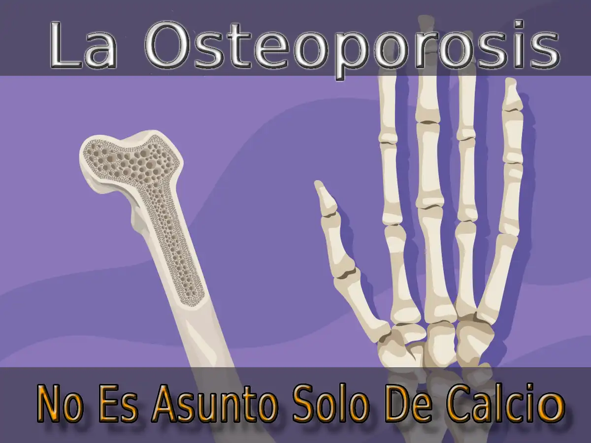 La Osteoporosis No Es Solo Asunto De Calcio