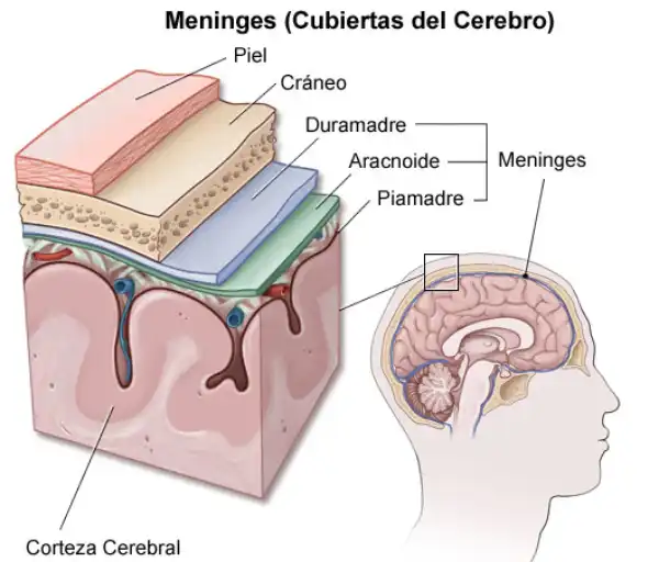 Meningitis-Cubiertas-Del-Cerebro