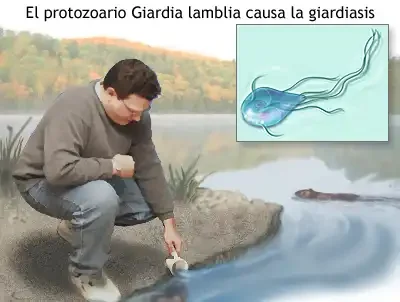 Propagacion-Giardia-Causas